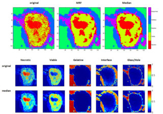 Imaging Mass Spectrometry Daten